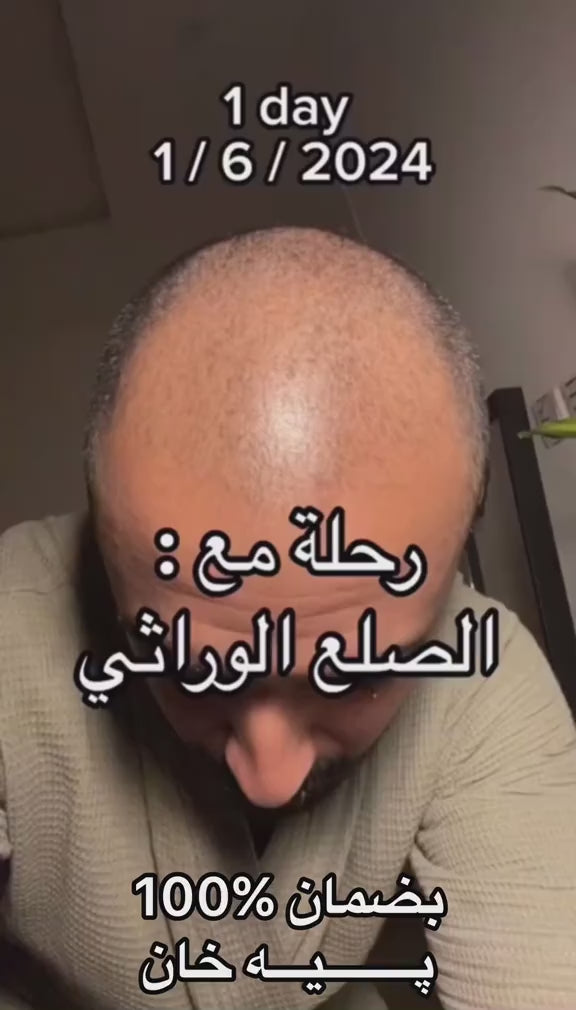 بودرة السدرة عبوتين ب 70 الف